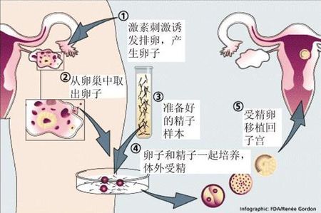 关于暖阳生殖